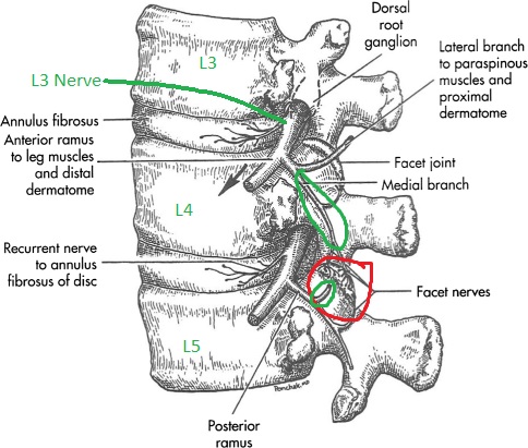 Lumbar Medial Branch Block And Radiofrequency Ablation, 60% OFF