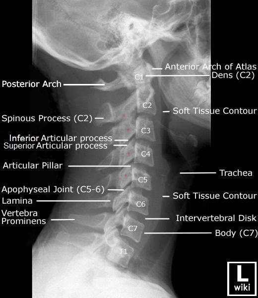 Cervical Thoracic Placement Example 