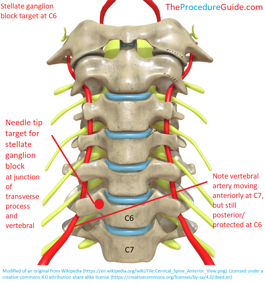 Anatomy of the scapula. Modified from Wikimedia. This file is licenced